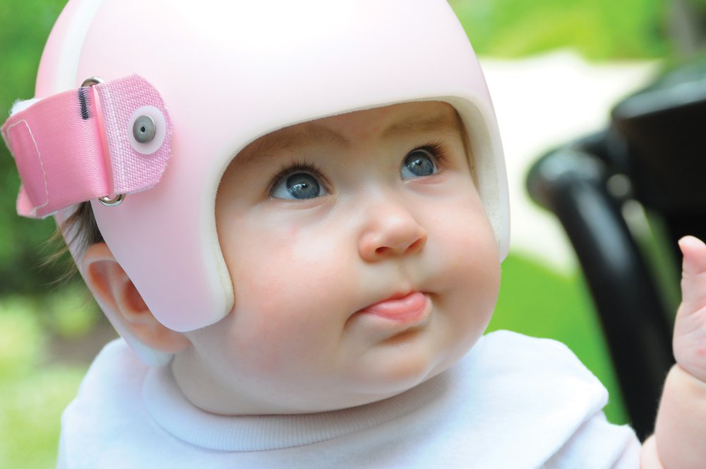 Cranial Remolding Helmet